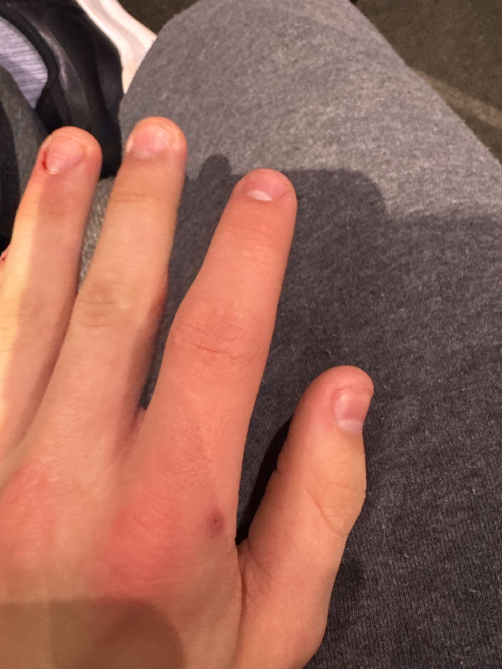 D3 to D1 to D2 to D1